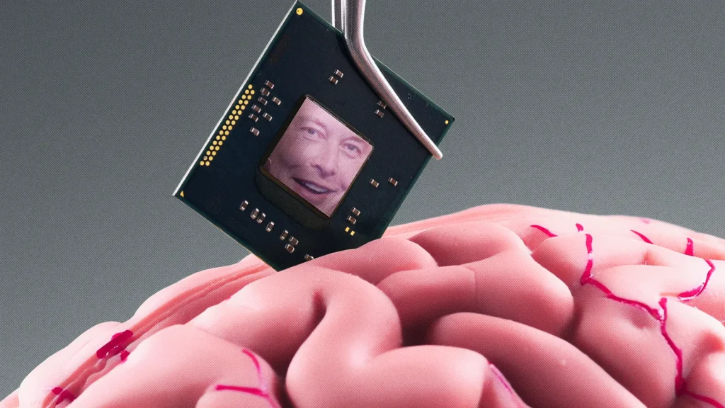 الشرائح الدماغية