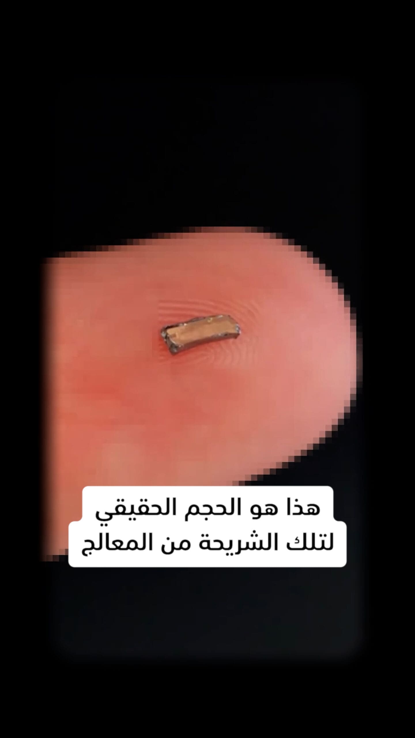 مع هذه اللقطة المجهرية، نرى عالم المعالجات من زاوية لا يمكن للعين المجردة تخيلها