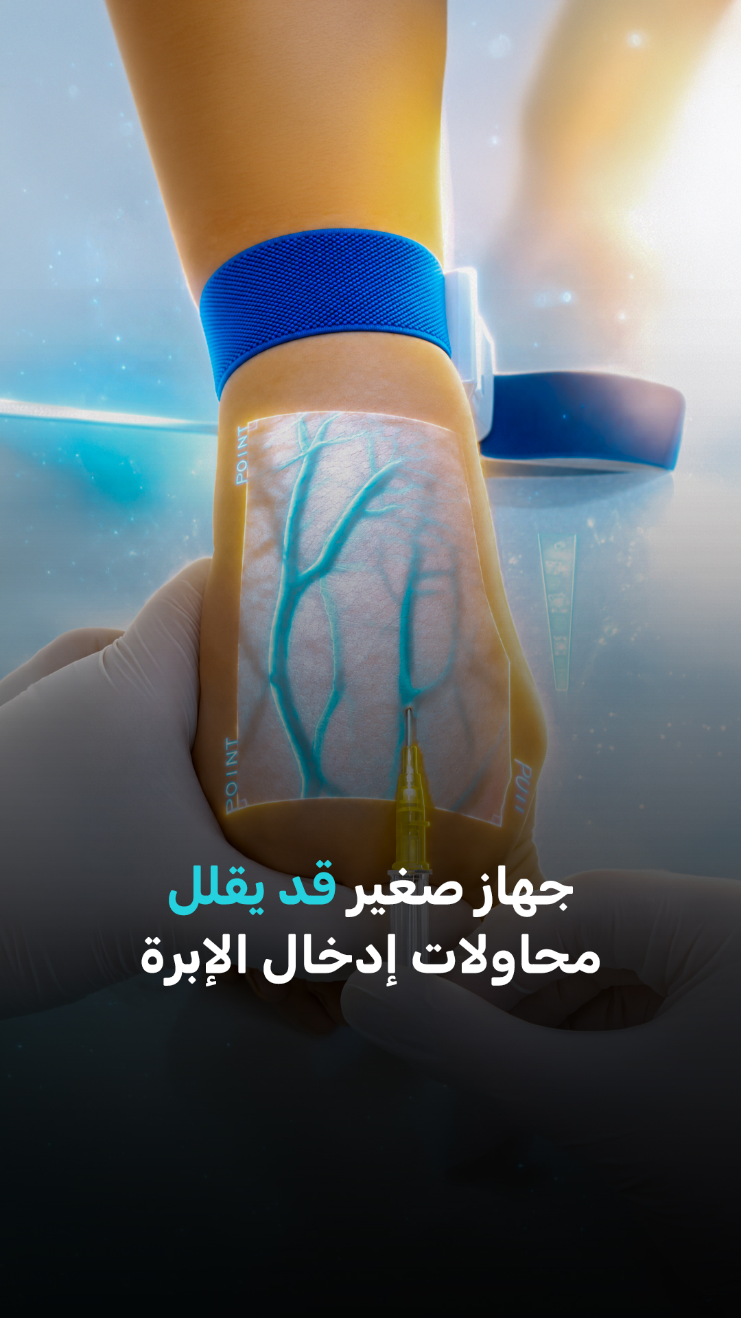 جهاز صغير قد يقلل محاولات إدخال الإبرة